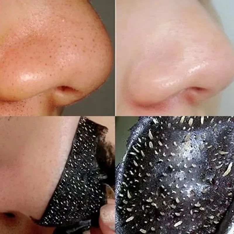 Blackhead Remover Mask harnesses the natural detoxifying power of bamboo charcoal to deeply cleanse pores