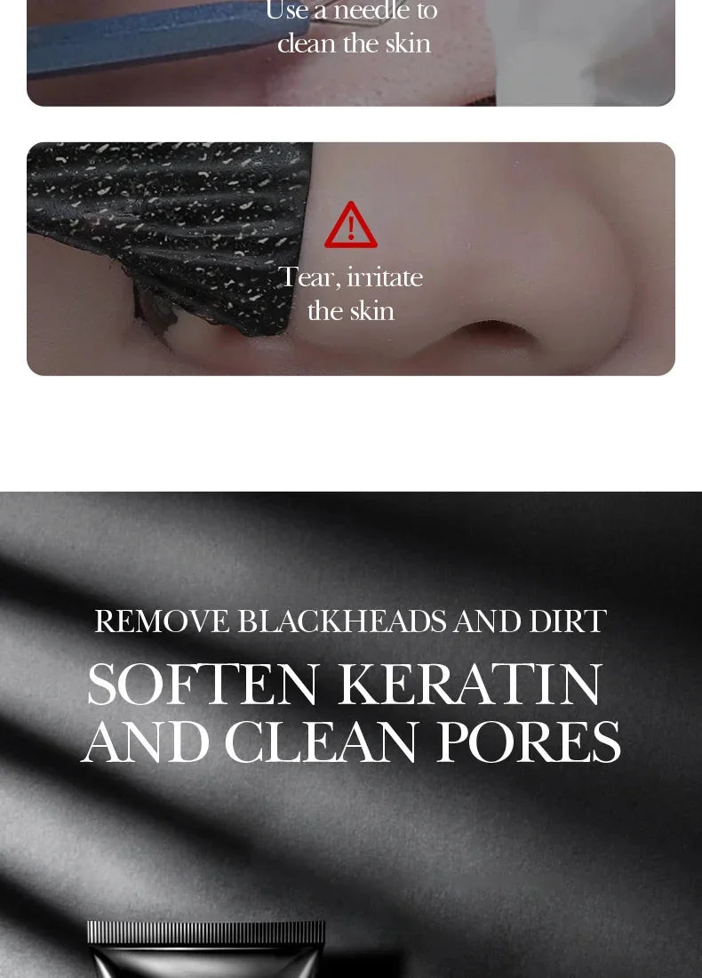 Blackhead Remover Mask harnesses the natural detoxifying power of bamboo charcoal to deeply cleanse pores