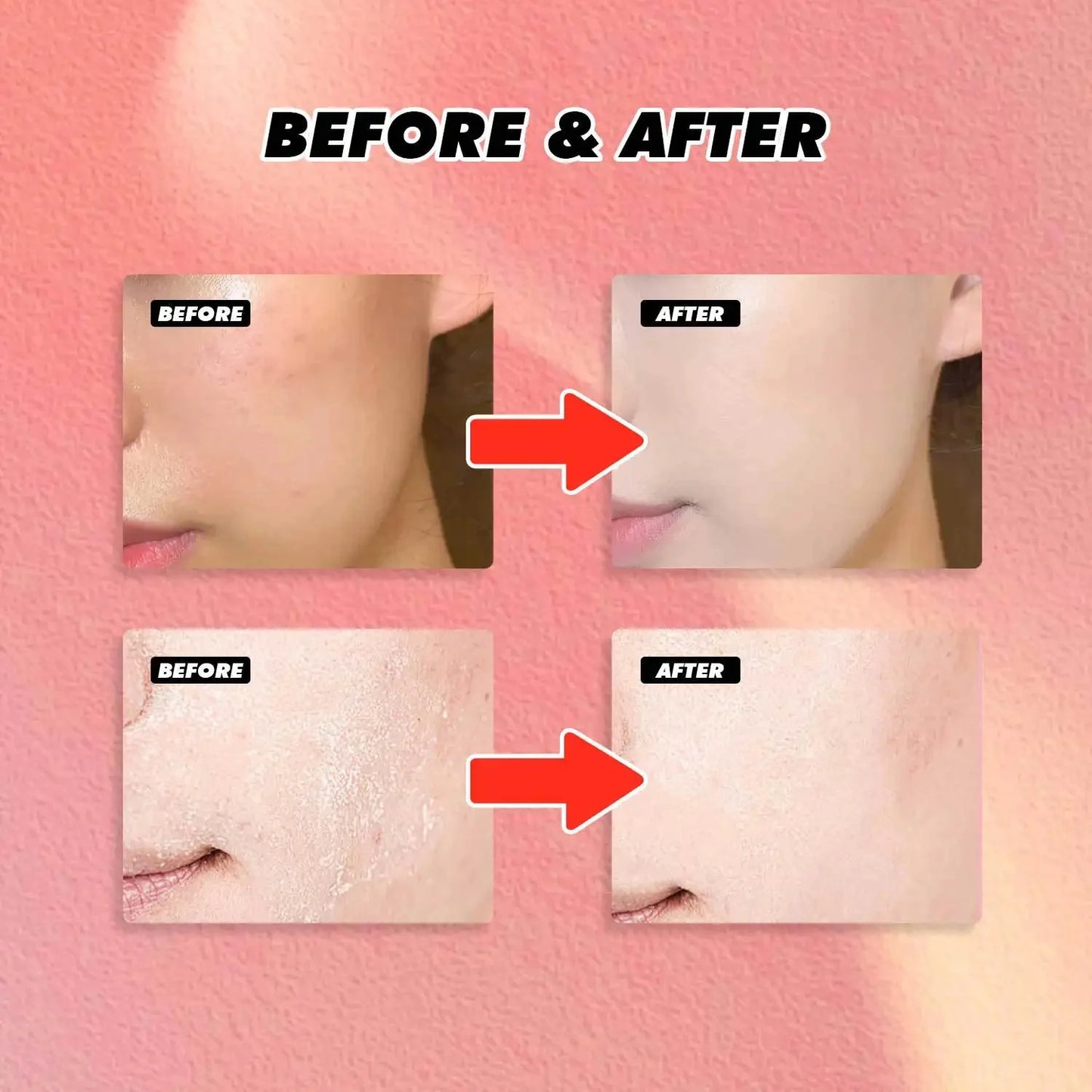 Jelly Cream combines deep hydration with powerful pore refining and brightening benefits